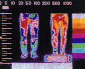 Thermal Diagram of Circulation while Standing